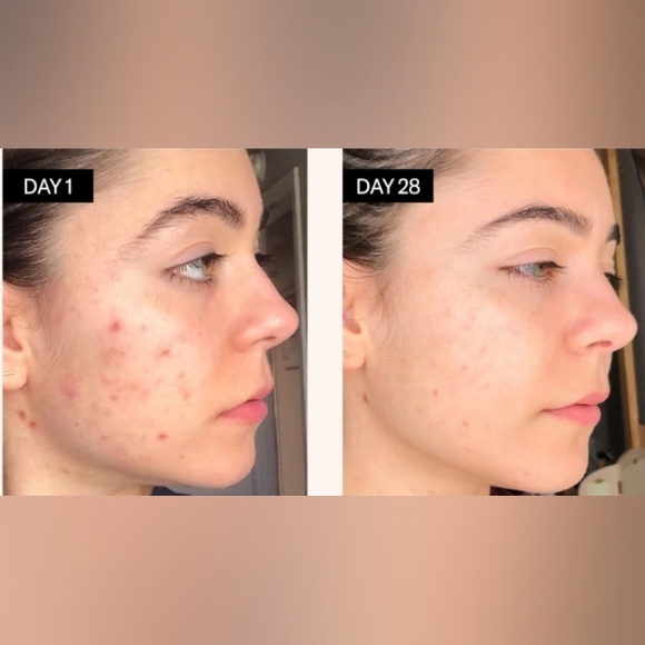 Odacite BL + C Black Cumin Cajeput Facial Serum Concentrate - Picture 3 of 5